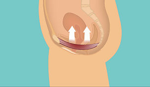 wow-l2-womens-health-in-later-years-id10098-04.jpg